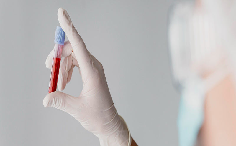 demanda-de-hemocentro-regional-aumenta-em-quase-70